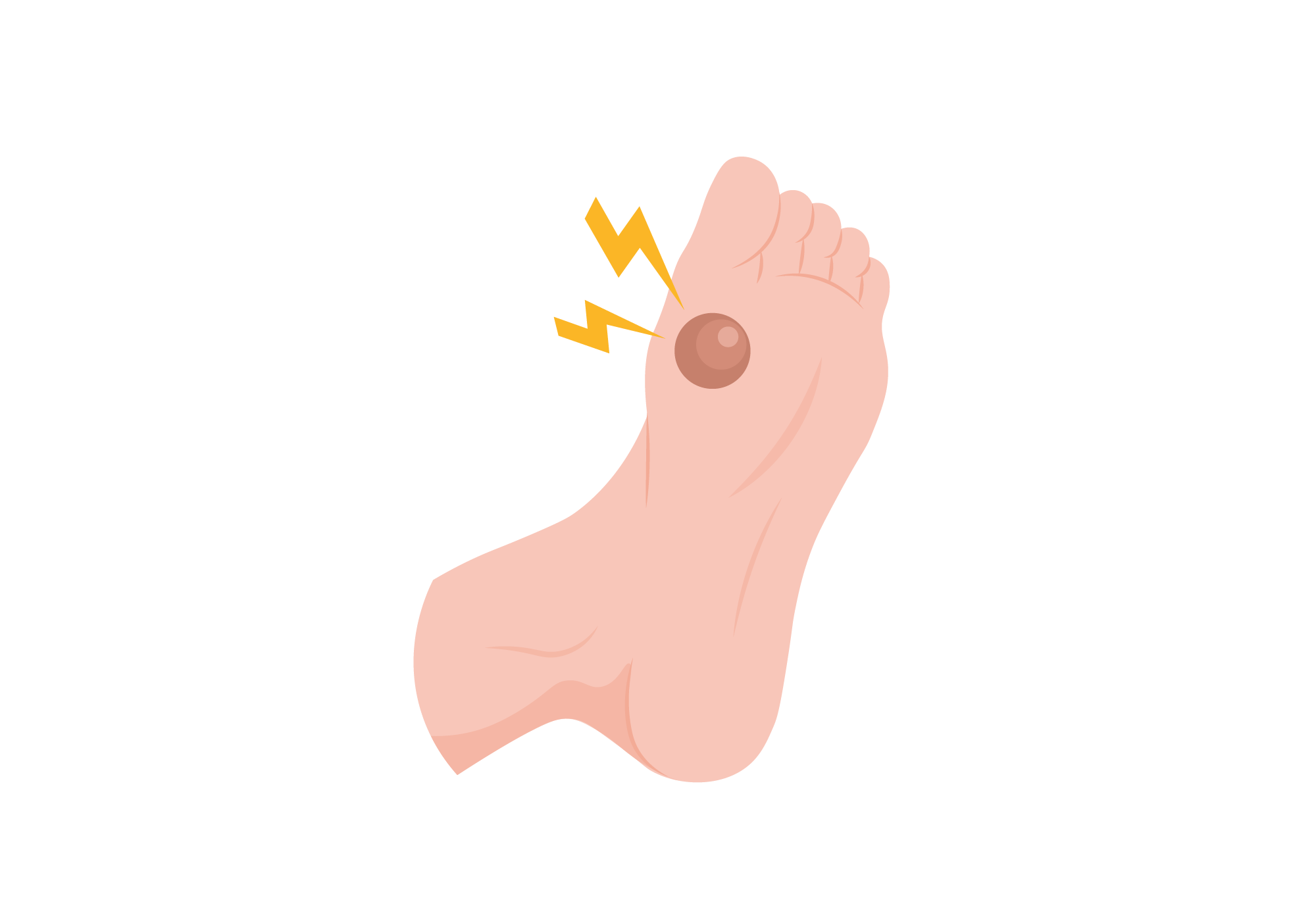 3,675 Blister Foot Images, Stock Photos & Vectors | Shutterstock - Clip ...