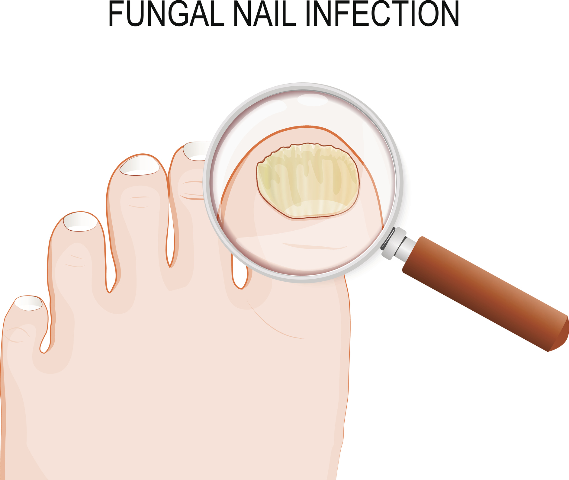 Toenails Stock Illustrations – 271 Toenails Stock Illustrations - Clip ...