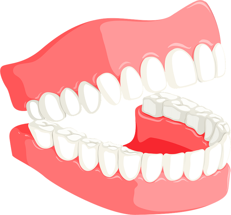Full Dentures Explained - Types, Fit, and Care Guide