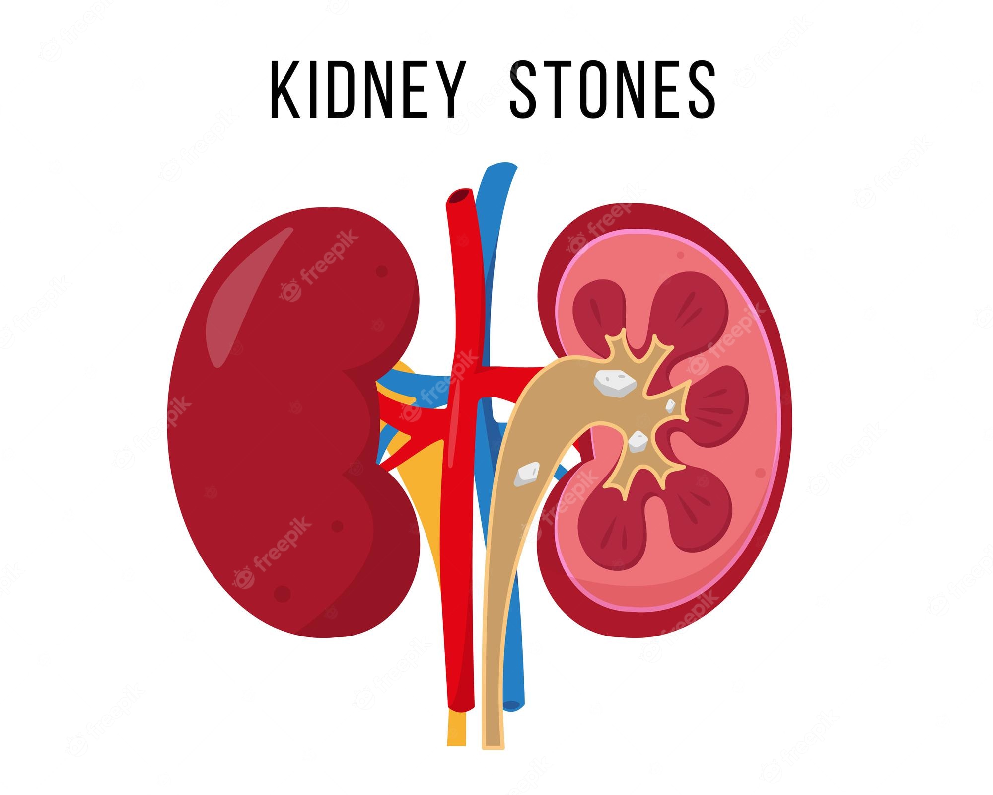 Kidney Vector Illustration Royalty Free Svg, Cliparts, Vectors - Clip 