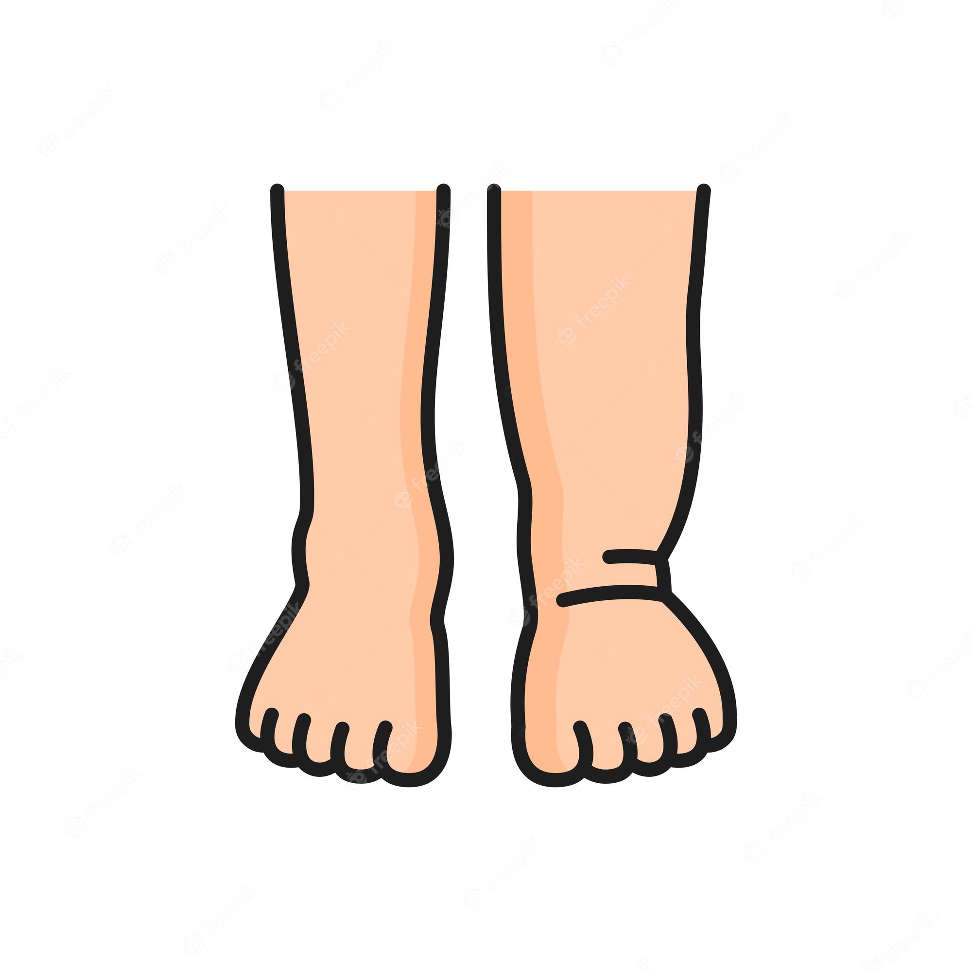 Swell clipart mosquitoBite 1 Manipal The Talk Network Clip Art Library