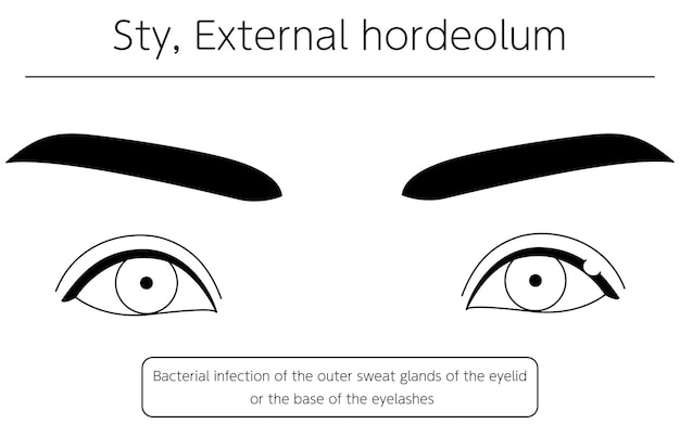 External Attacks Stock Illustrations – 1,271 External Attacks 