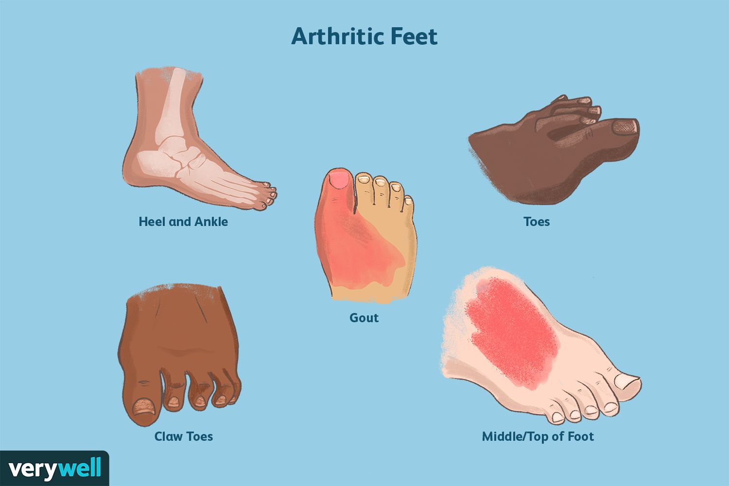 Big Toes Clip Art Library