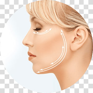 Side profile of a woman with white arrows indicating facial lifting directions for cosmetic treatment.