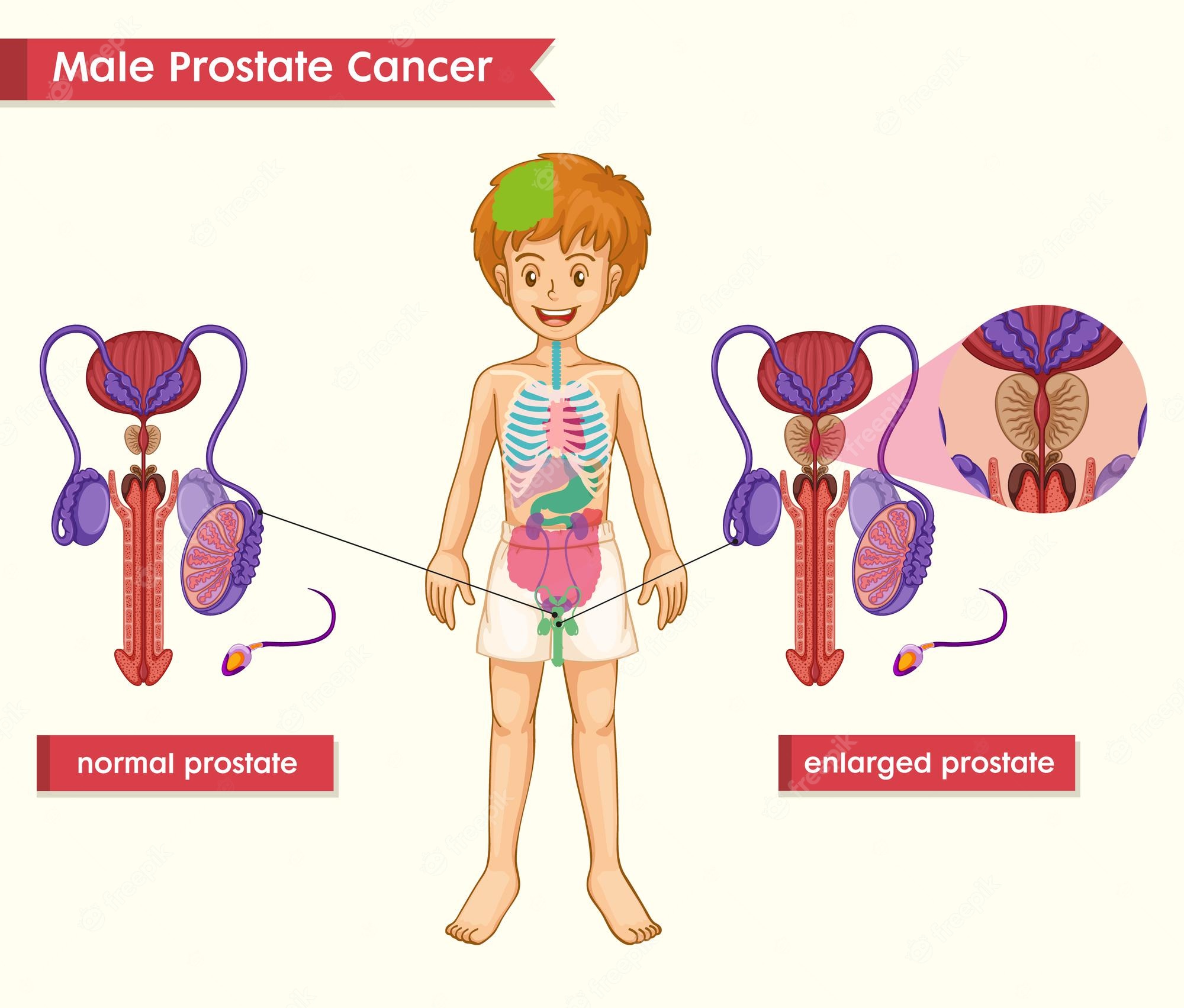 Prostate Exam Check Color Icon Digital Rectal Examination Prostate prostate-exam-check-color-icon-digital-rectal-examination-prostate