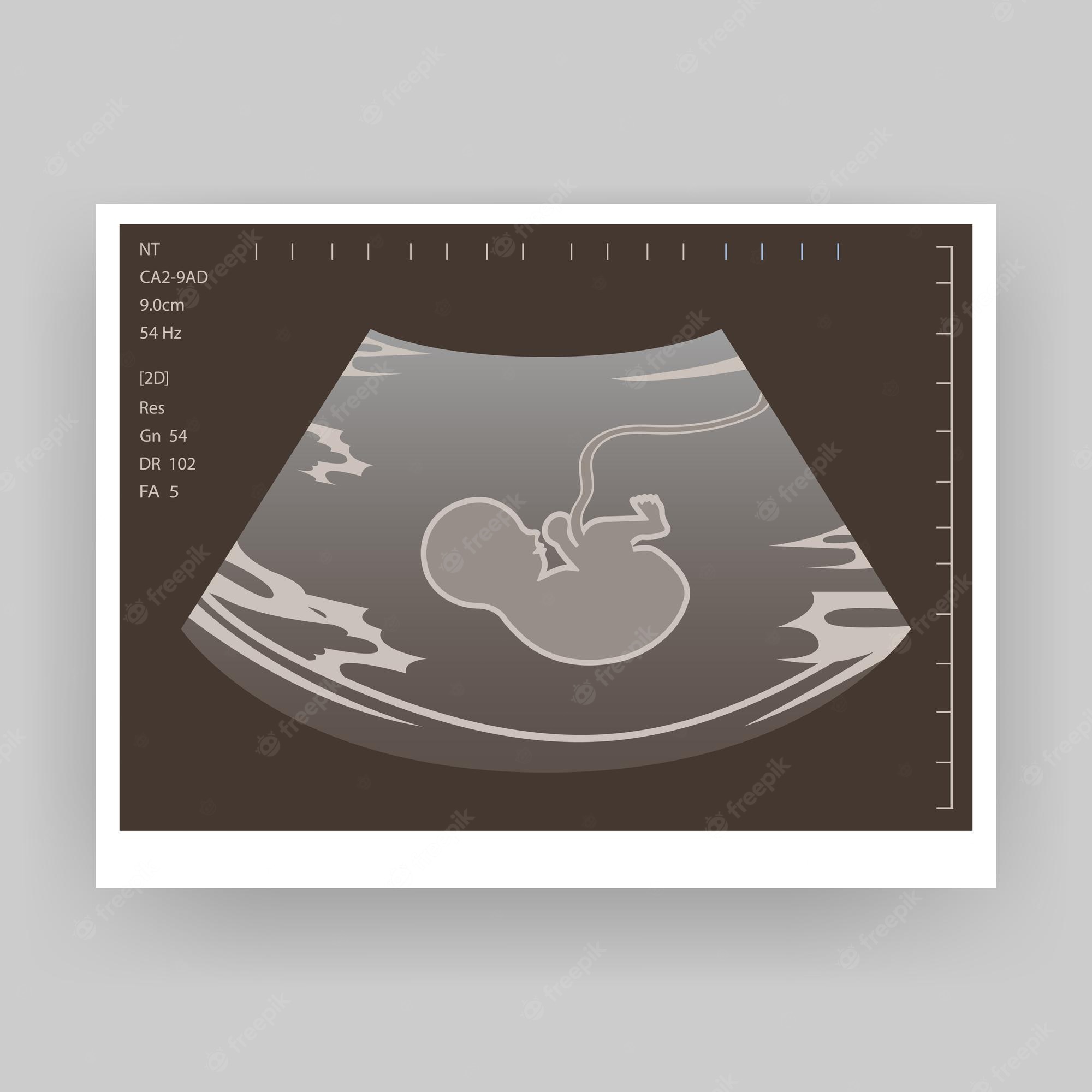 baby-ultrasound-stock-illustrations-4-822-baby-ultrasound-stock