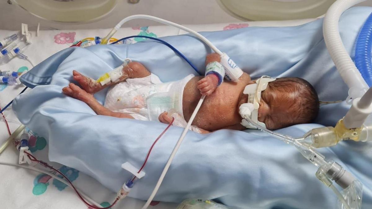 Bug-spread baby deaths could have been prevented - BBC News
