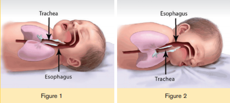 baby deaths