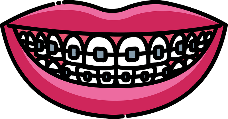 Smile with braces - Free vector clipart images on clipart library.com