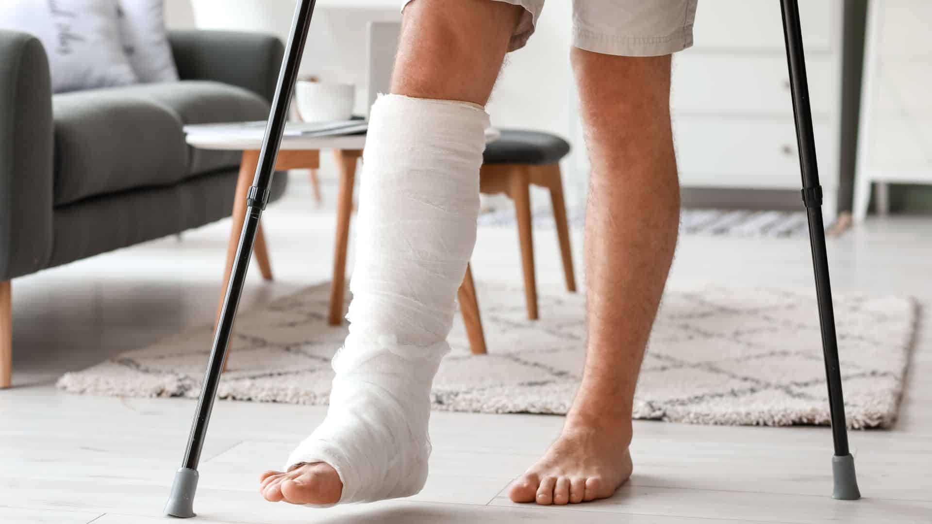 broken leg pics