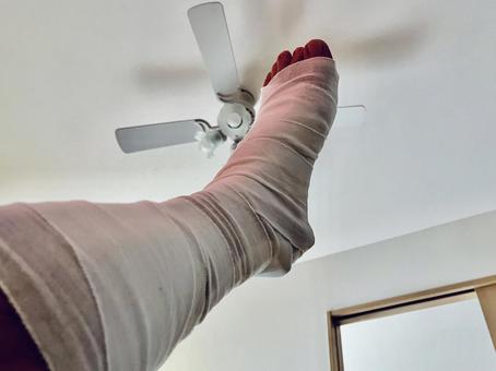 Free Photos | broken leg