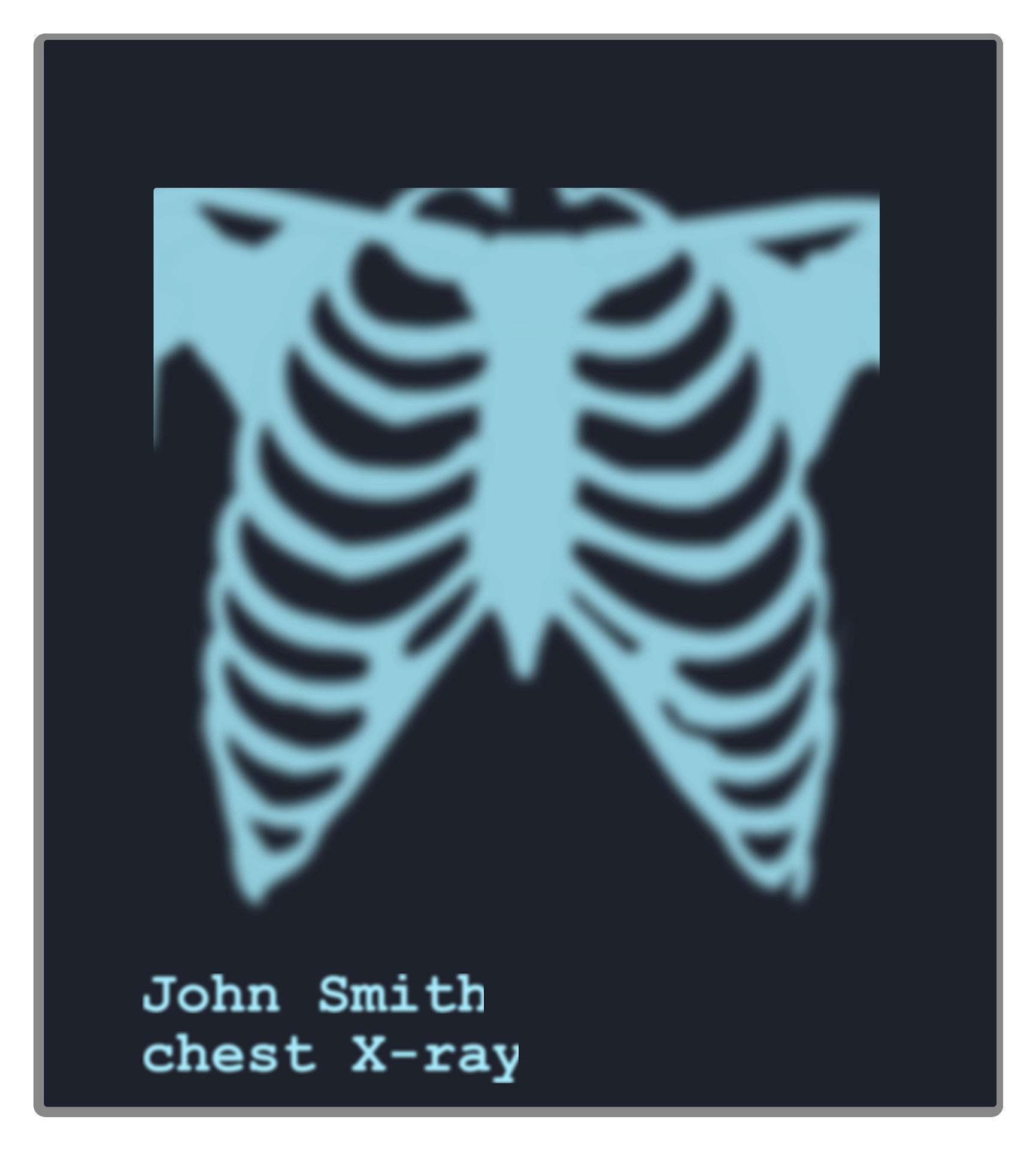 chest xray cliparts