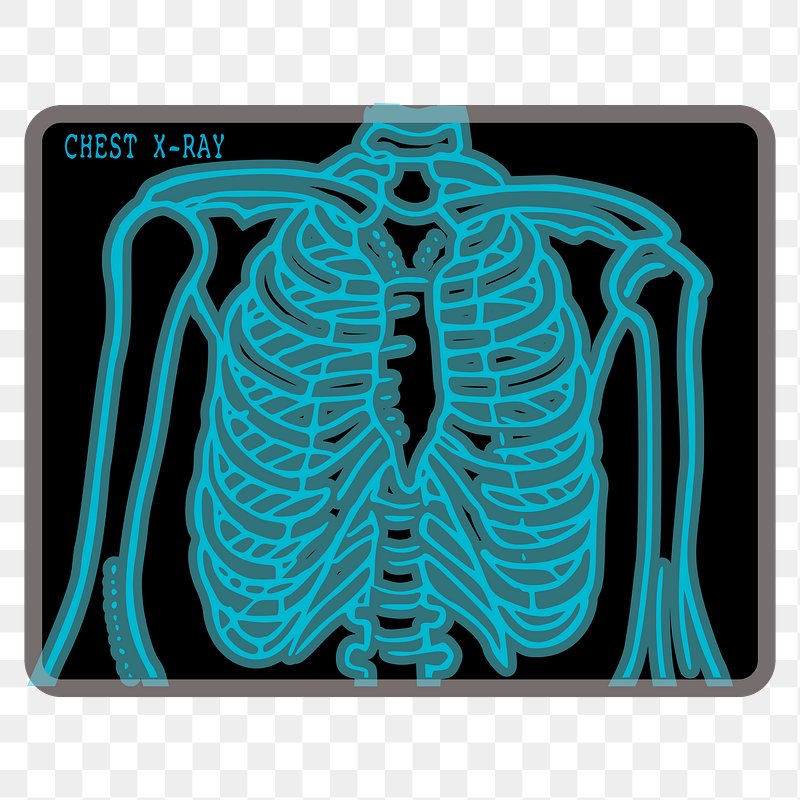 chest xray cliparts