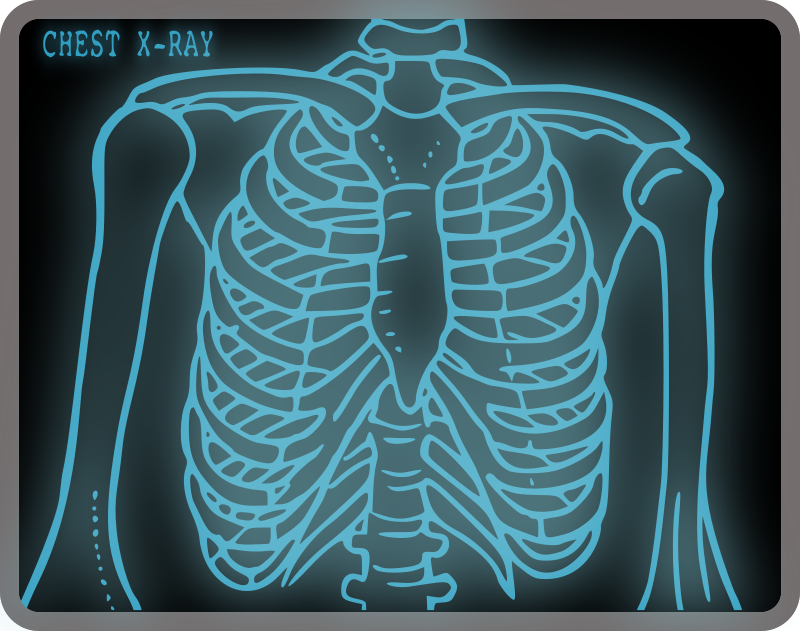 chest xray cliparts