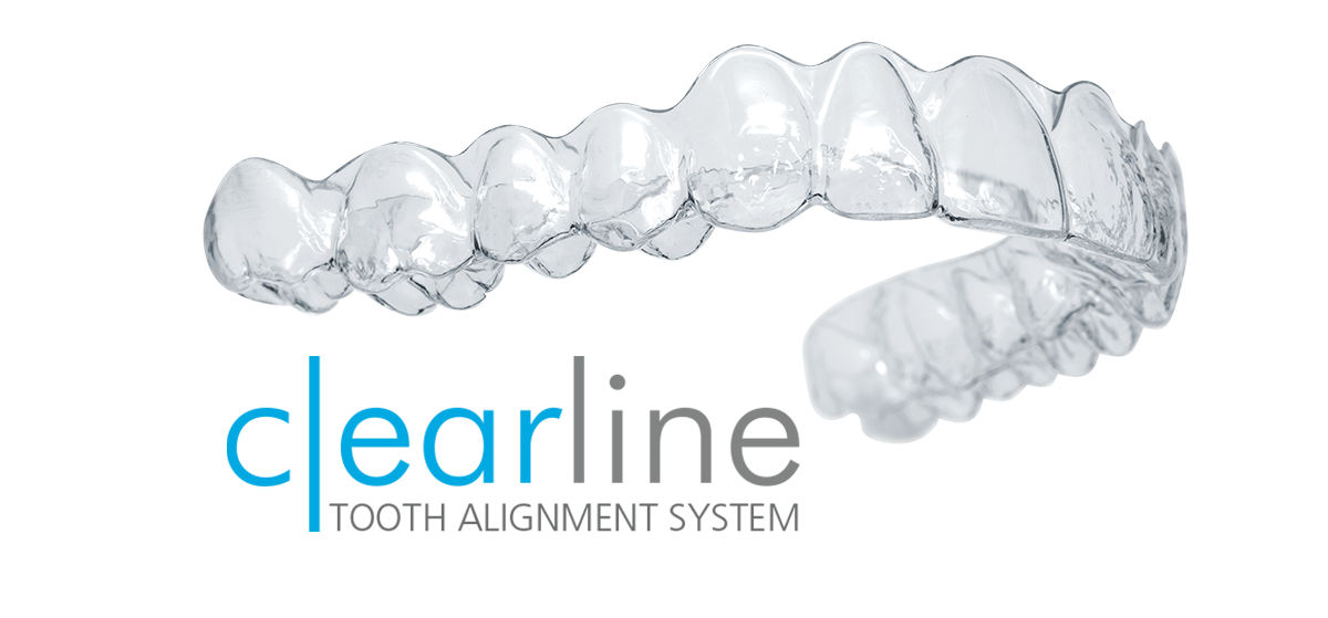 ClearLine Aligners | Orthodontic Tool Treatment Alignment System
