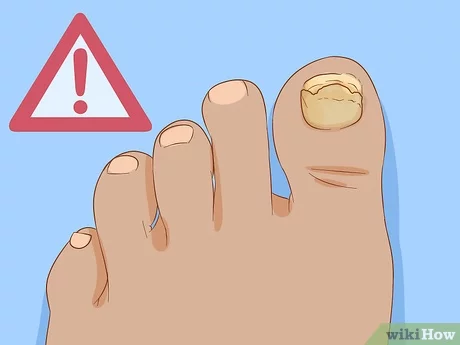 cliparts big toenail