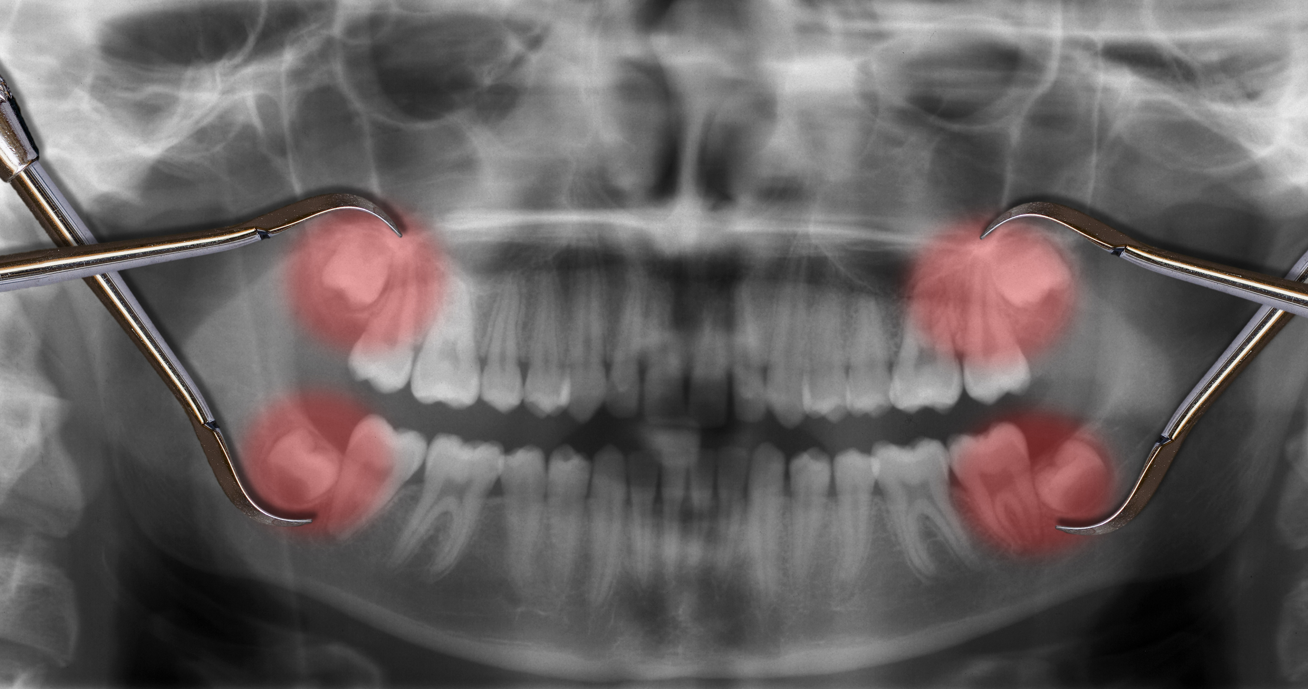 dental surgery pictures