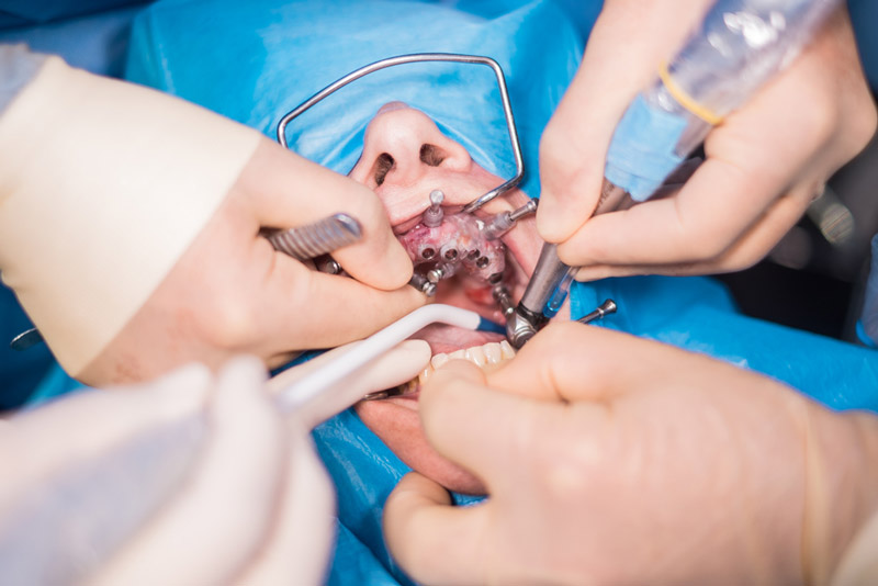 dental surgery pictures