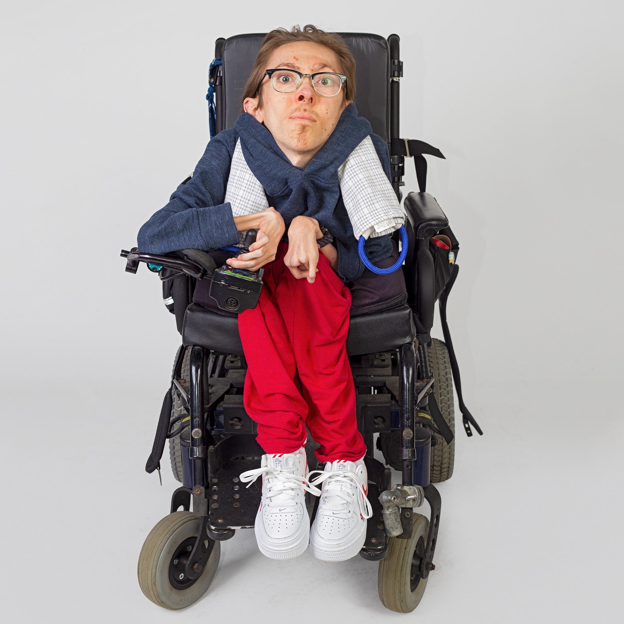 I learned to love my disabled body – why cant my non-disabled ...