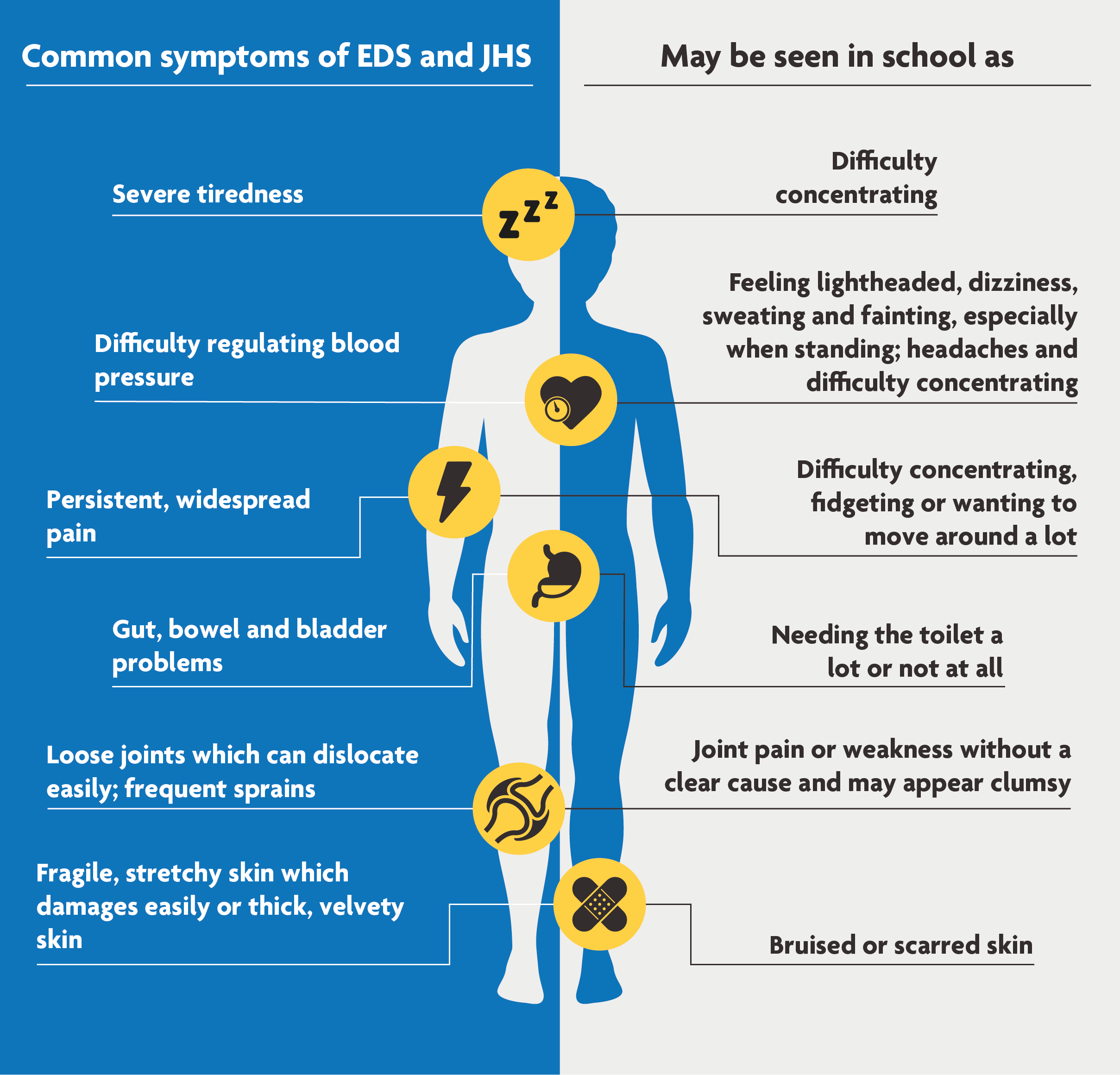 eds