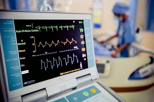 EKG Machine and ECG Machine Buyers Guide For Medical ...