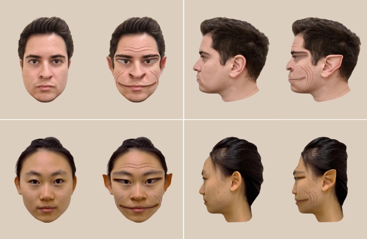 If Faces Appear Distorted, You Could Have This Condition | Dartmouth