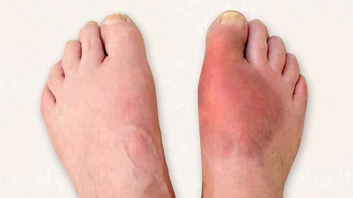 Foot Health: Common Issues and How to Manage Them