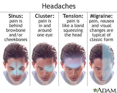 head hurtings