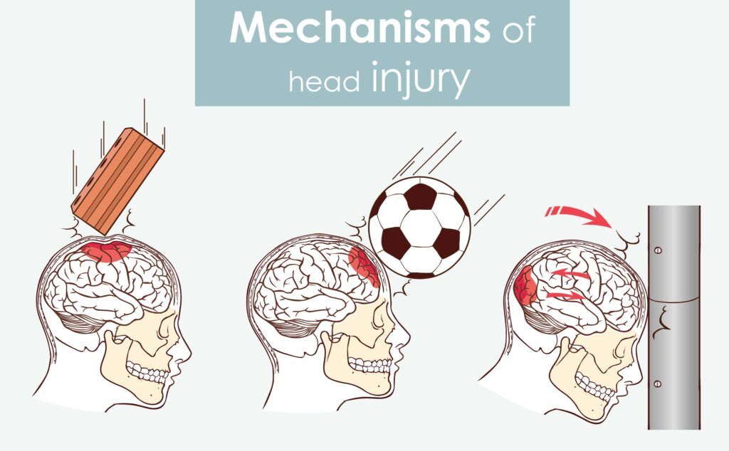 Neurology Insights: Understanding the Most Common Types and Causes ...