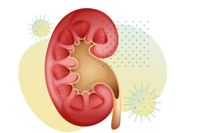 kidney transplant clipart