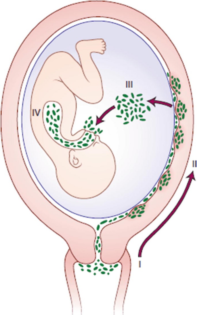 kis infection cliparts