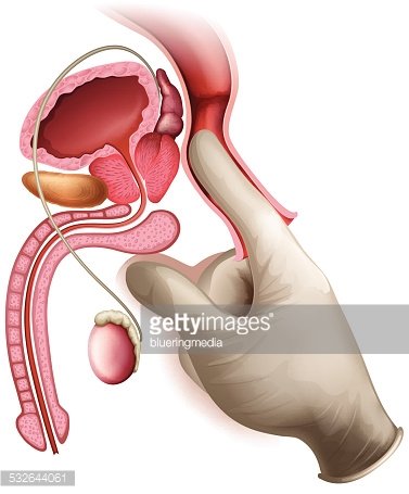 Prostate Cancer Stock Clipart | Royalty-Free | FreeImages