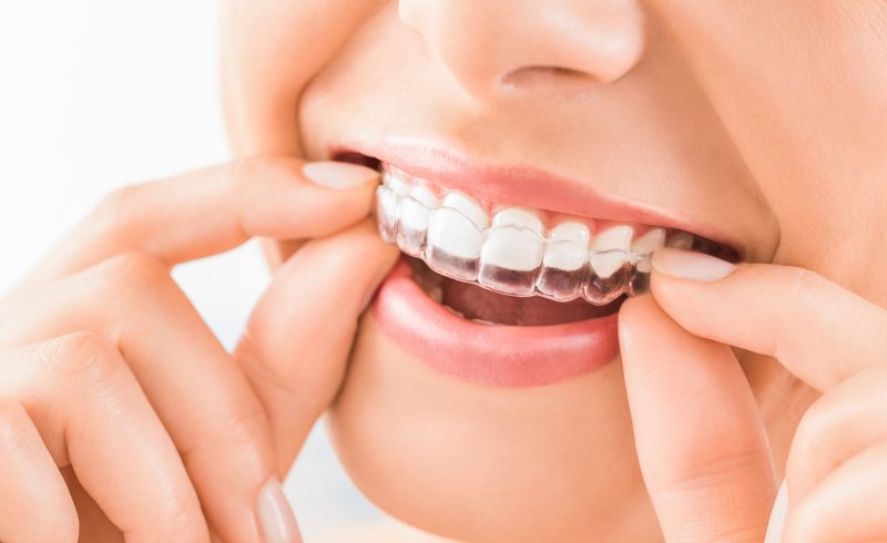 What Are Invisalign Refinements? | Struble Orthodontics