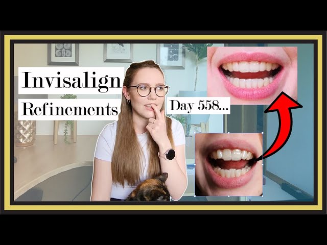 Invisalign Refinements Update (18 months later) | Cracked Tray ...