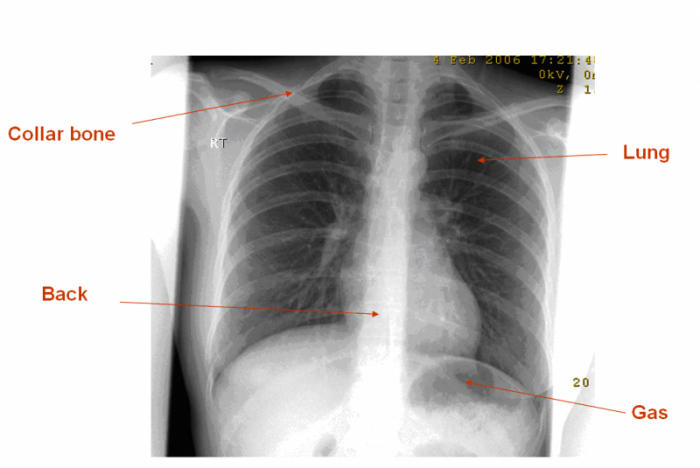 simple x rays
