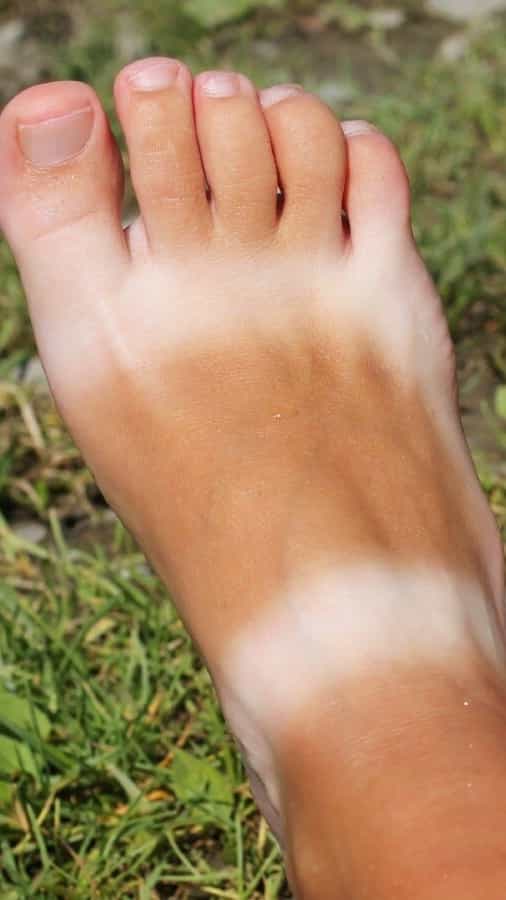 8 tips to remove feet tanning