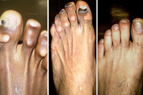 toess football