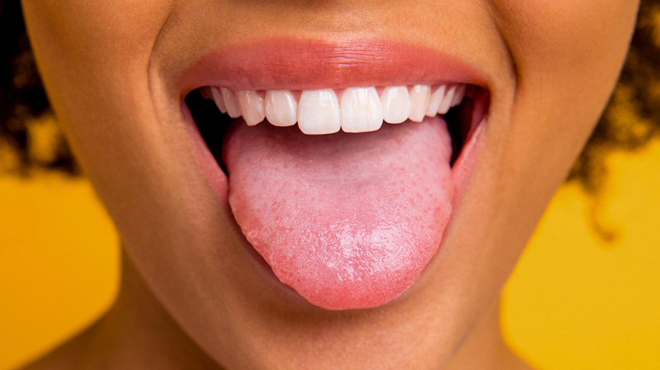 Fissured Tongue: Pictures, Symptoms, Causes &amp; More