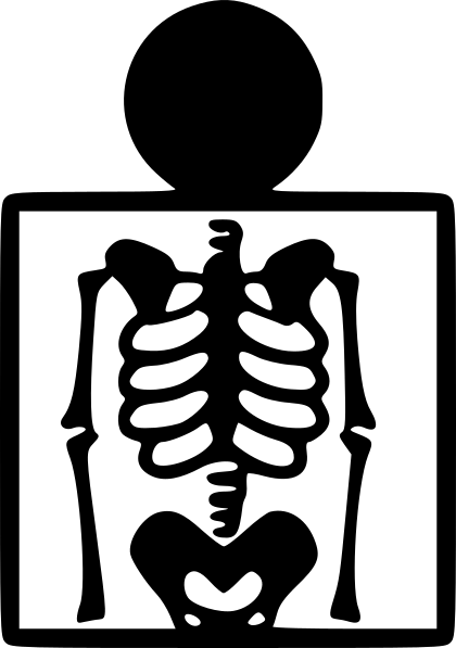 X-rays PNG transparent image download, size: 420x597px