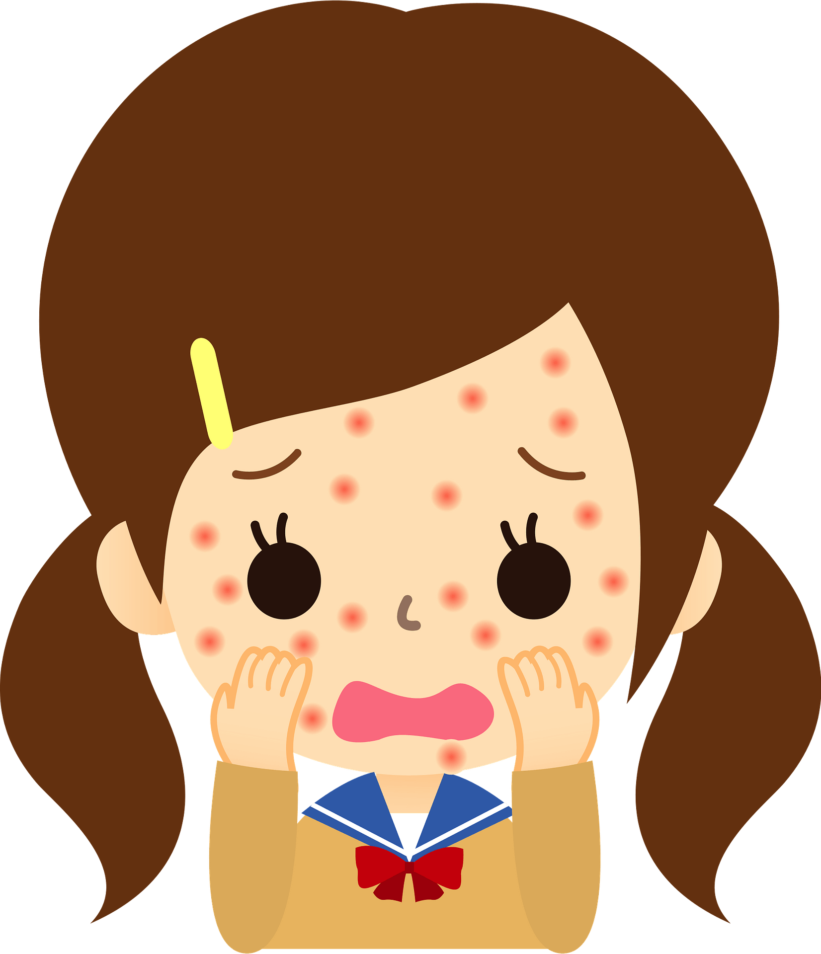 11,300+ Acne Illustrations, Royalty-Free Vector Graphics & Clip - Clip ...