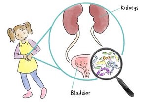 uti clipart