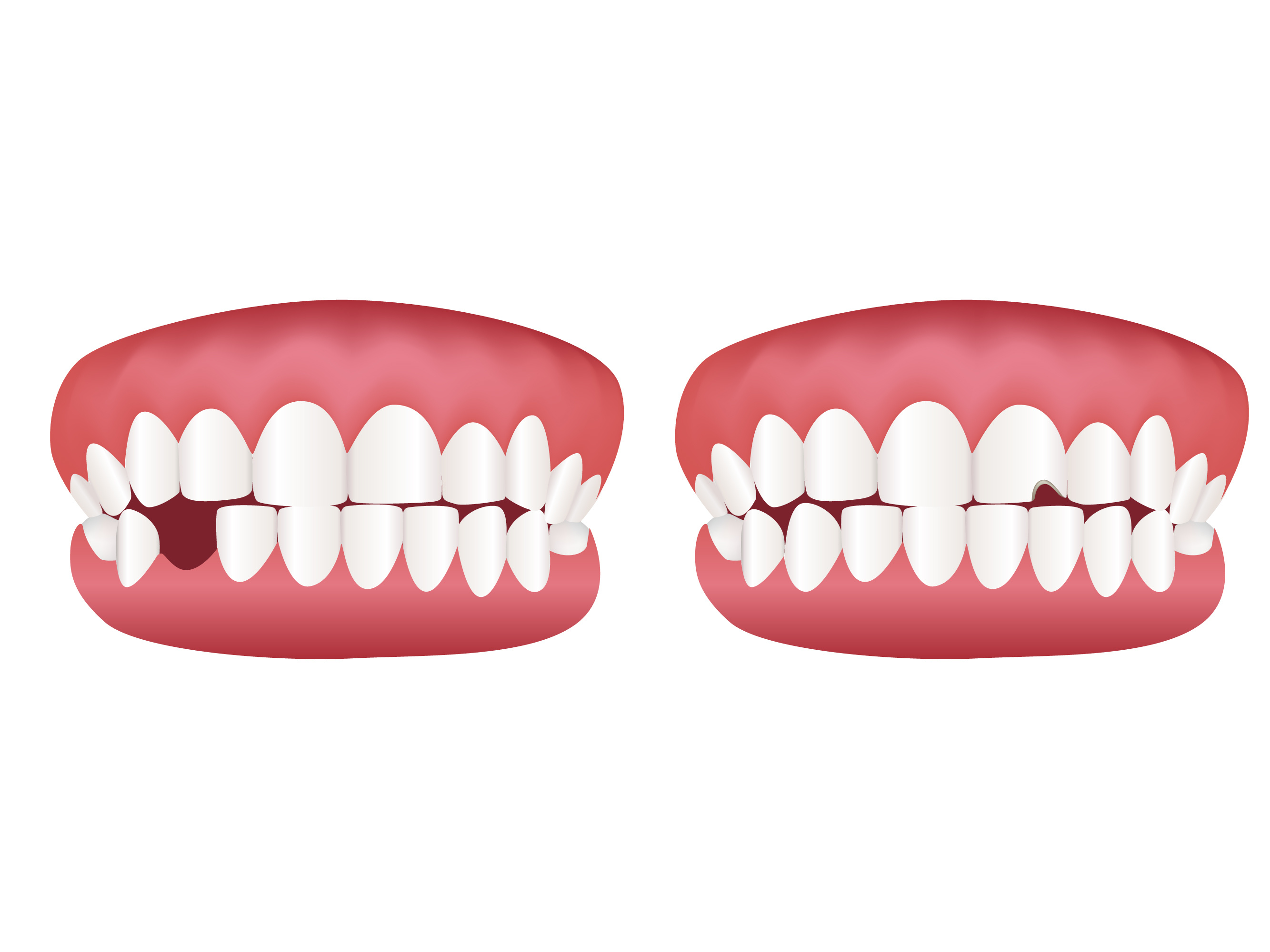 Teeth Clipart Vector Art, Icons, and Graphics for Free Download - Clip ...