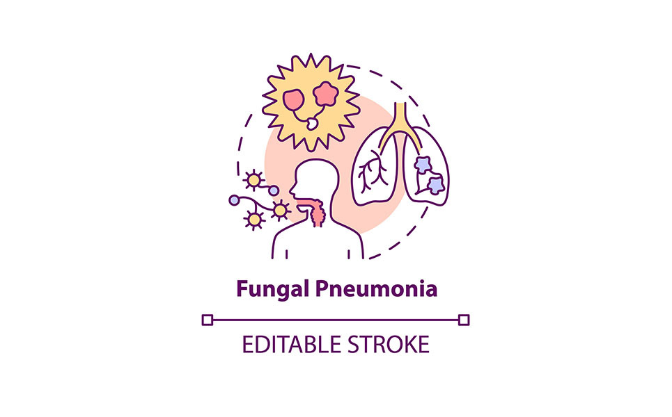 Pneumonia a leading cause of emergency department visits in Canada ...