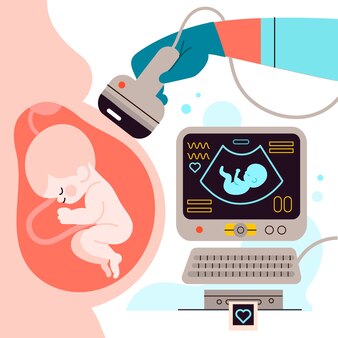 ultrasound clipart