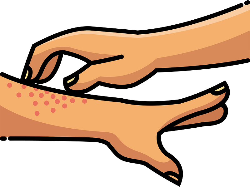 Dry Skin Stock Illustrations – 9,143 Dry Skin Stock Illustrations 