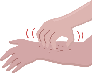 itch clipart
