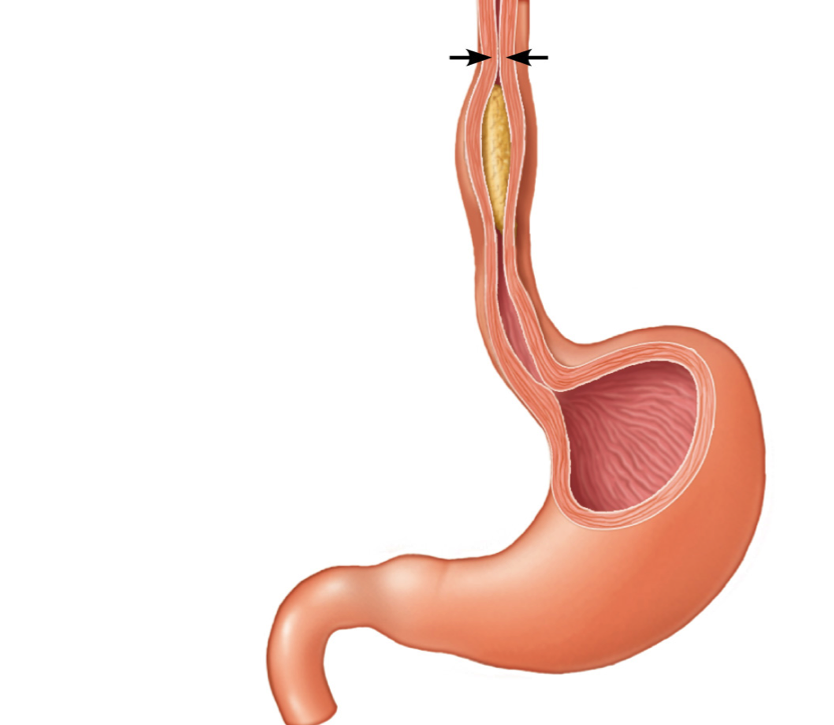 Расслаблен желудок. Сфинктеры желудка и пищевода. Пищевод и желудок анатомия человека. Верхний пищеводный сфинктер. Пищевод анатомия без подписей.