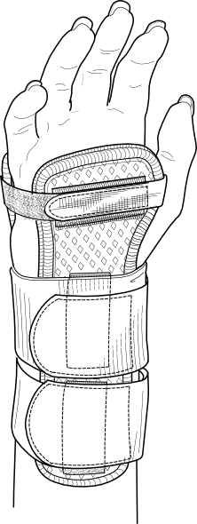 Line drawing of a wrist brace with adjustable straps and palm support, shown on an anatomical hand.
