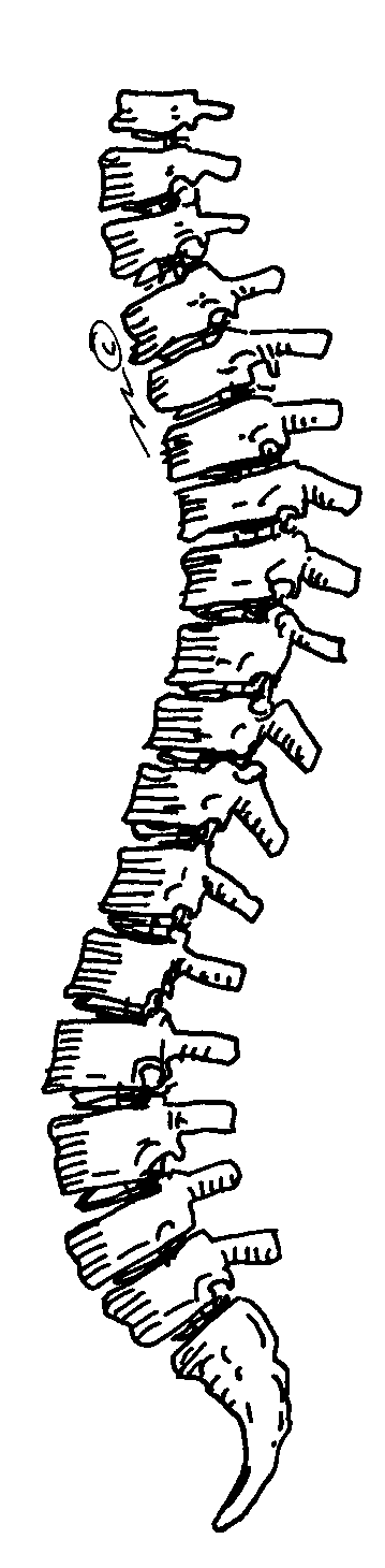 curved spine clipart