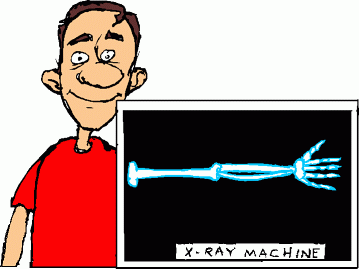 X-Ray Machine Illustration - Medical Imaging Concept